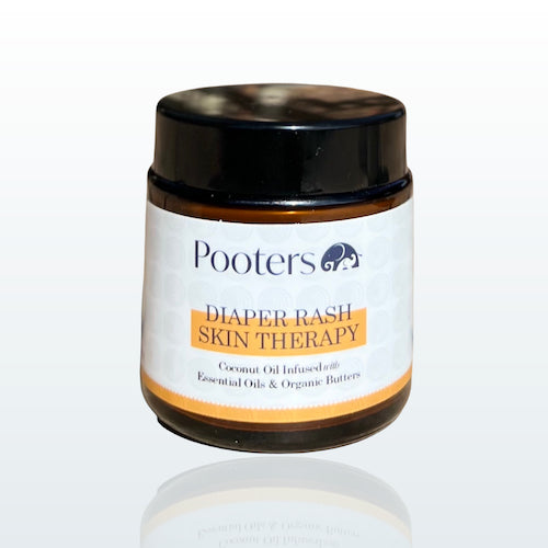 Organic Coconut Oil Diaper Balm + Essential Oils to Treat Diaper Rash